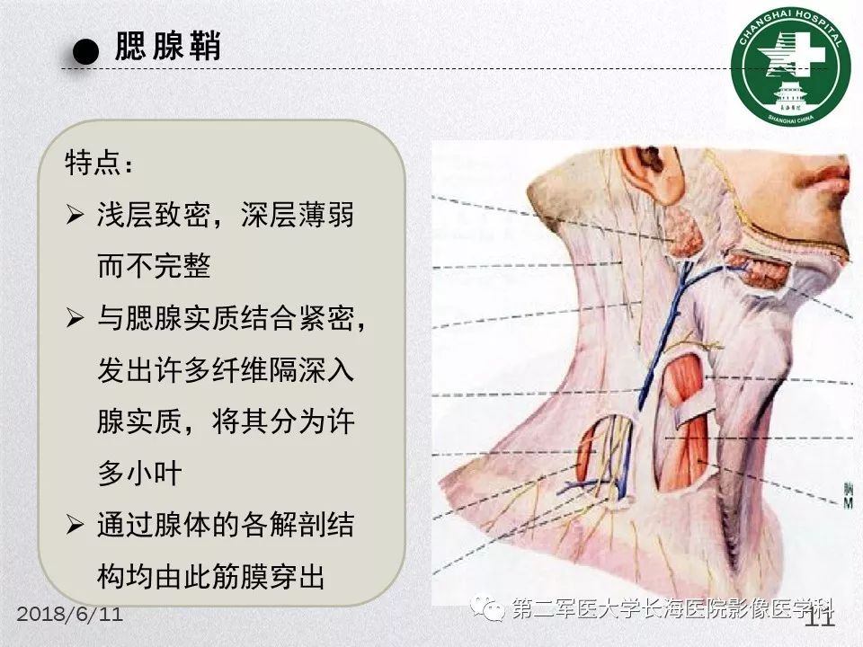 影像PPT - 【PPT】腮腺常见疾病-11