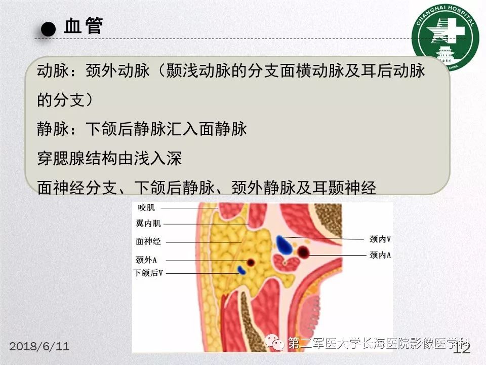影像PPT - 【PPT】腮腺常见疾病-12