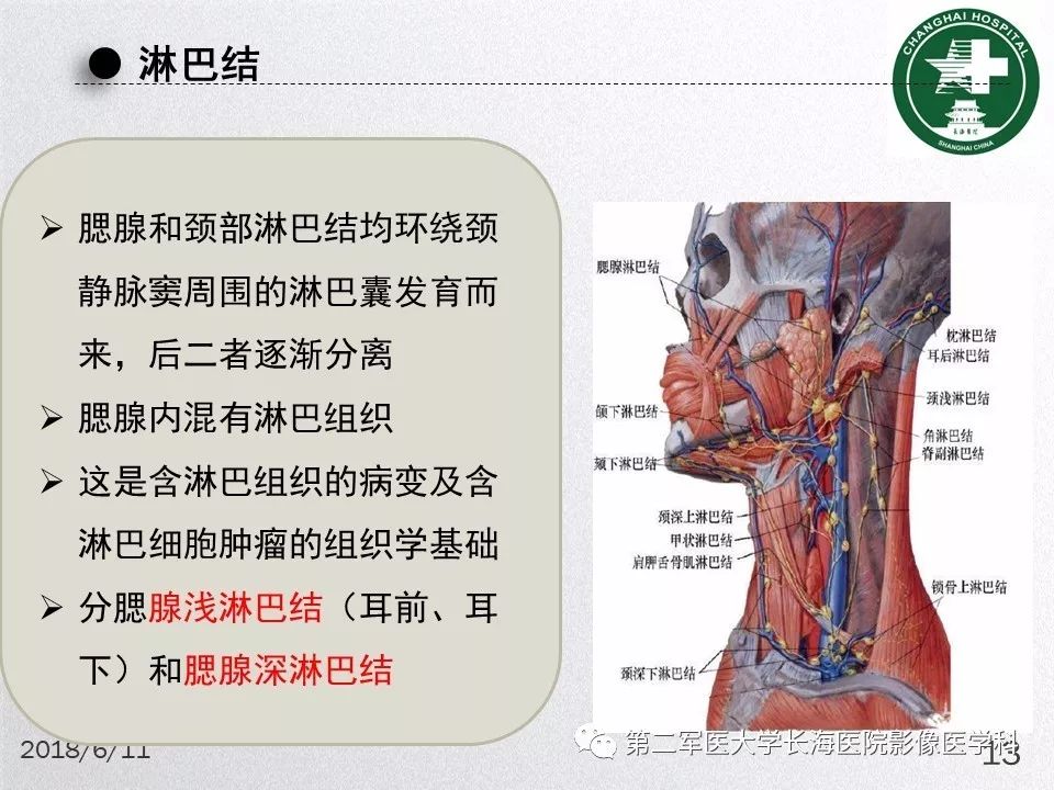 影像PPT - 【PPT】腮腺常见疾病-13