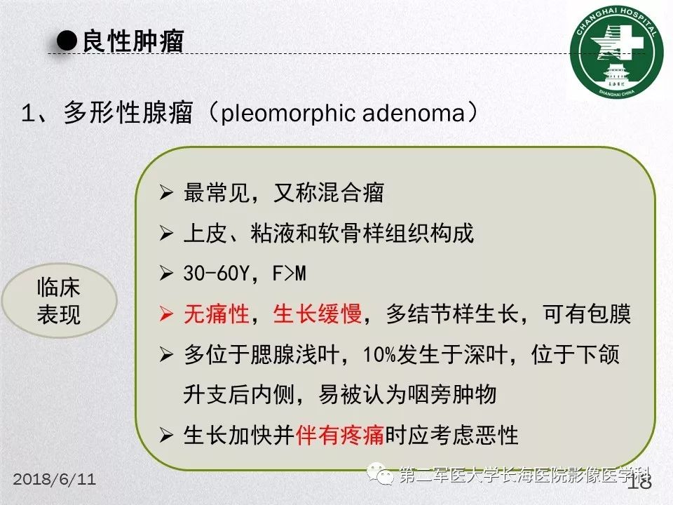 影像PPT - 【PPT】腮腺常见疾病-18