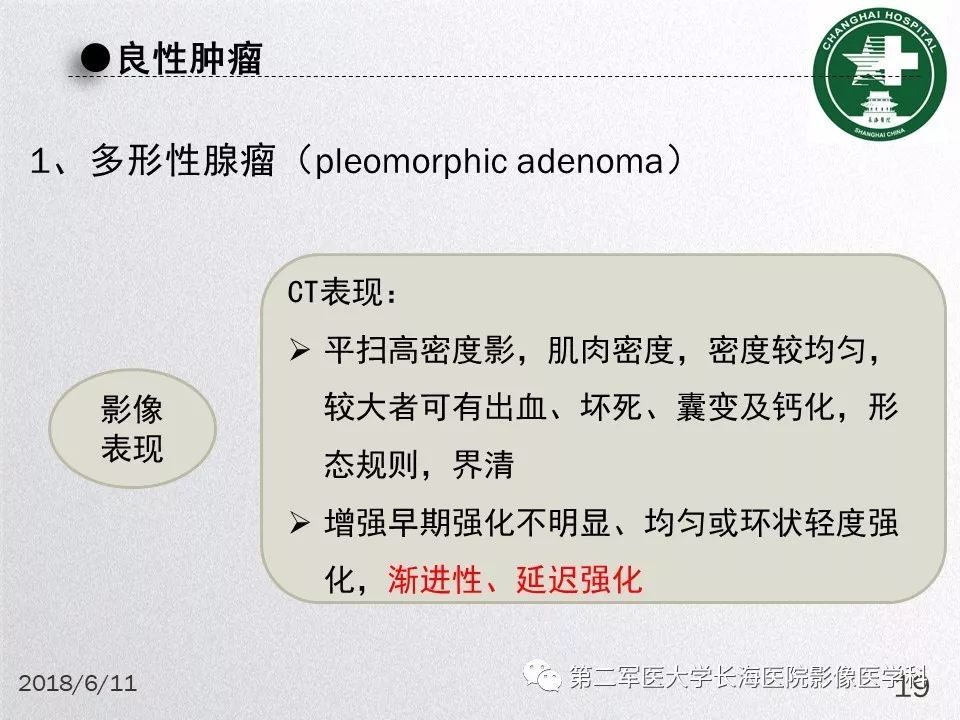 影像PPT - 【PPT】腮腺常见疾病-19