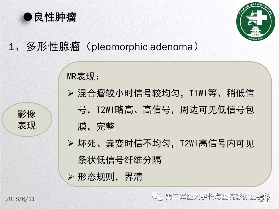影像PPT - 【PPT】腮腺常见疾病-21