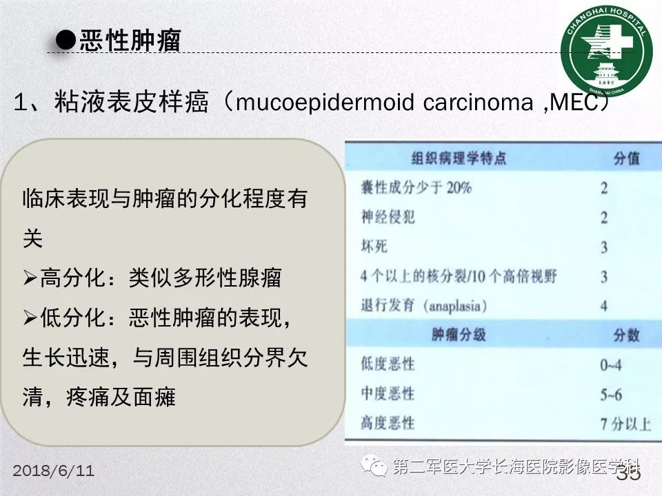 影像PPT - 【PPT】腮腺常见疾病-35