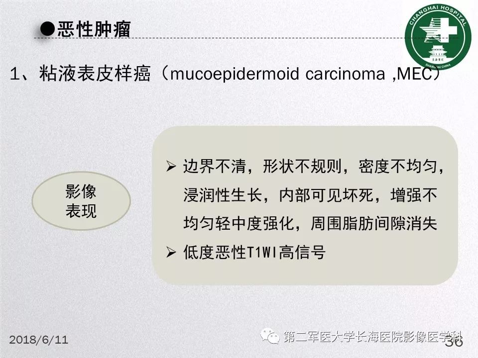 影像PPT - 【PPT】腮腺常见疾病-36