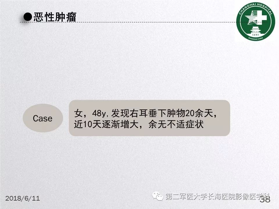 影像PPT - 【PPT】腮腺常见疾病-38