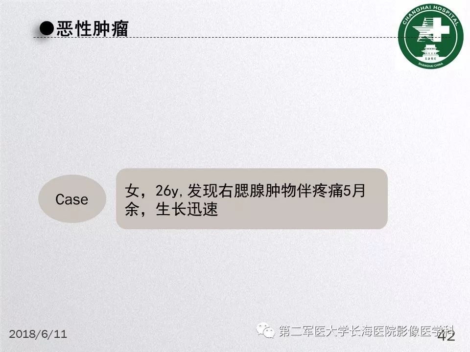 影像PPT - 【PPT】腮腺常见疾病-42