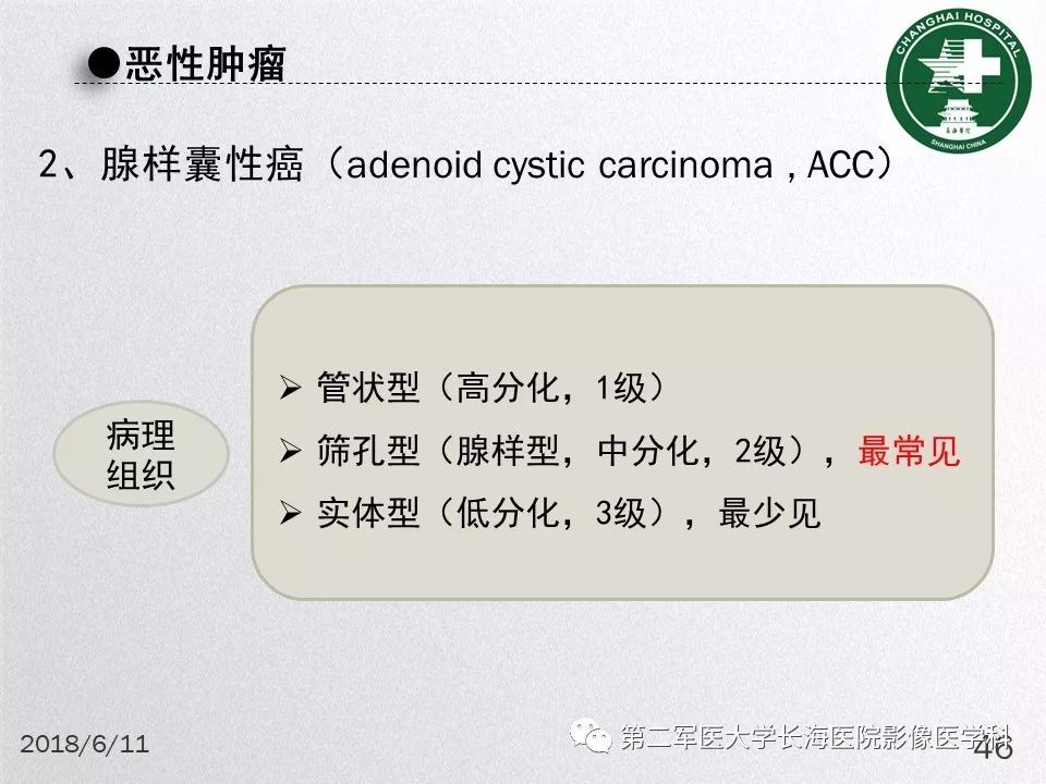 影像PPT - 【PPT】腮腺常见疾病-46