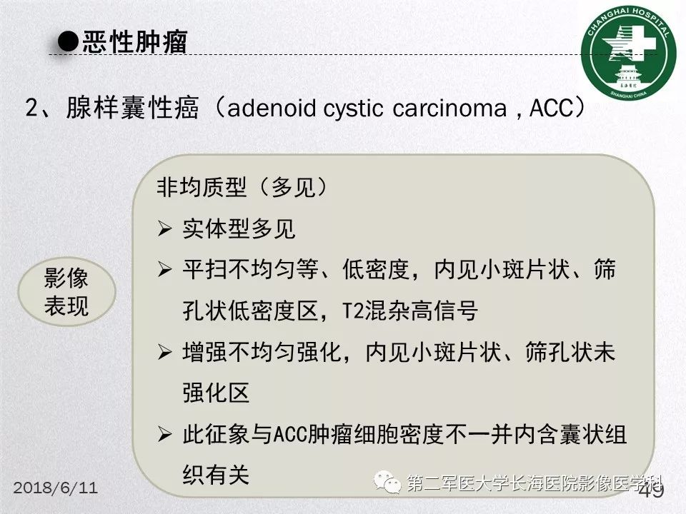 影像PPT - 【PPT】腮腺常见疾病-49