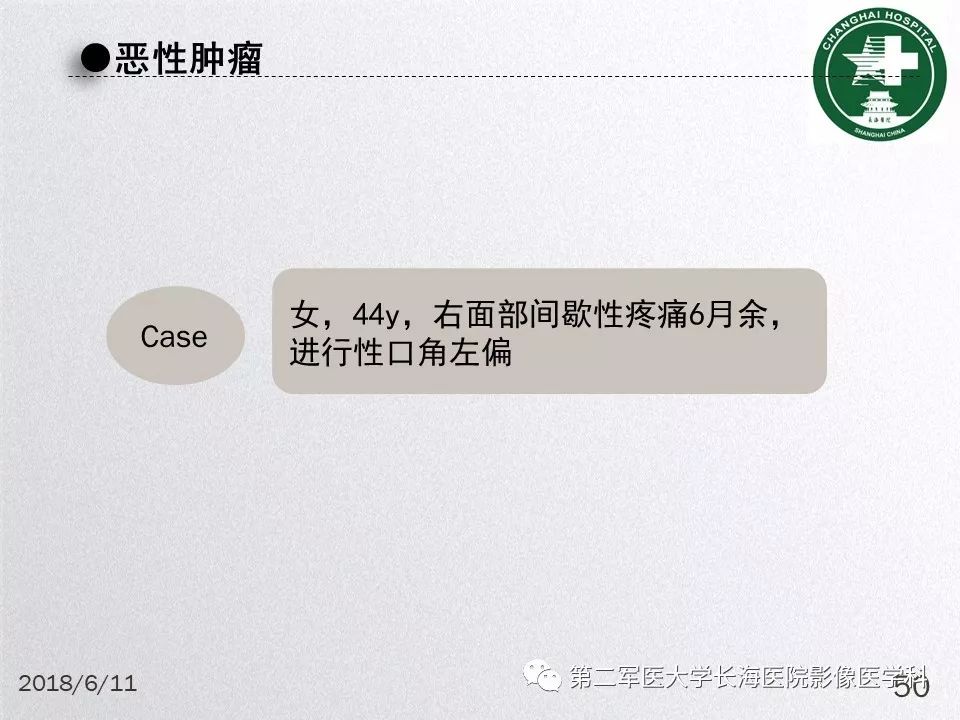 影像PPT - 【PPT】腮腺常见疾病-50