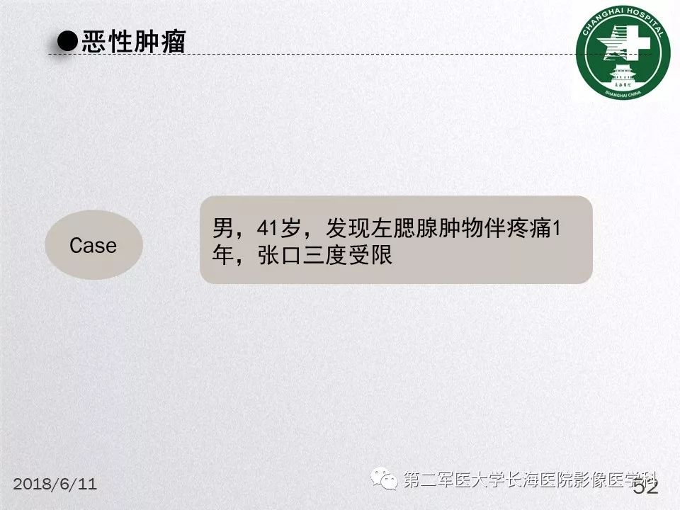 影像PPT - 【PPT】腮腺常见疾病-52