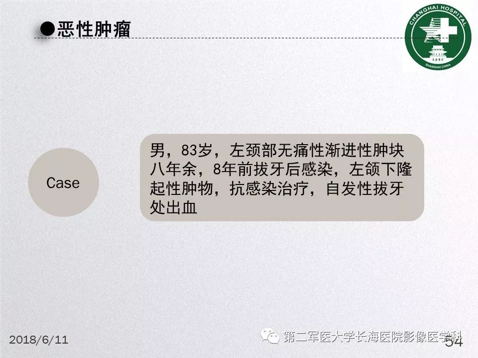 影像PPT - 【PPT】腮腺常见疾病-54