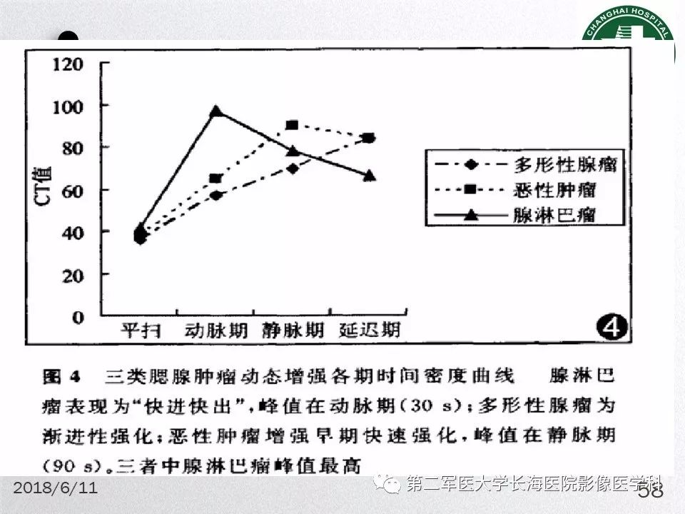 影像PPT - 【PPT】腮腺常见疾病-58