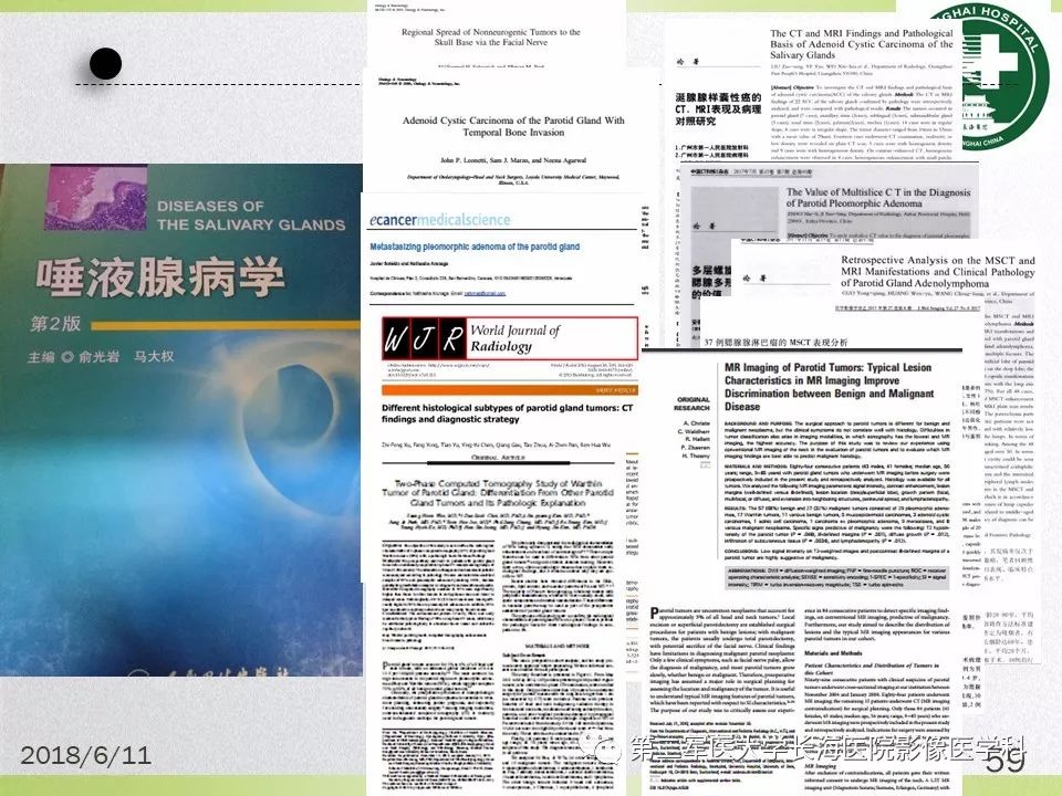 影像PPT - 【PPT】腮腺常见疾病-59