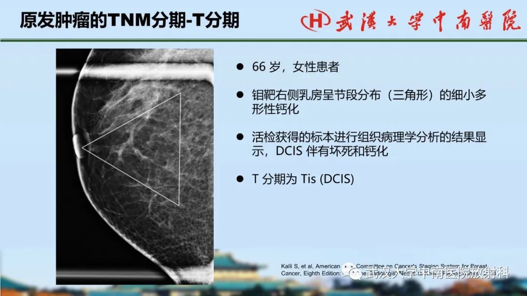 影像PPT - 【PPT】乳腺癌第八版TNM分期解读—影像科医生的责任和挑战-11