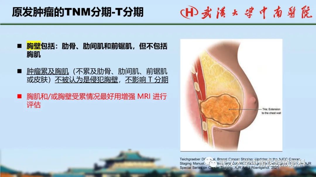 影像PPT - 【PPT】乳腺癌第八版TNM分期解读—影像科医生的责任和挑战-19
