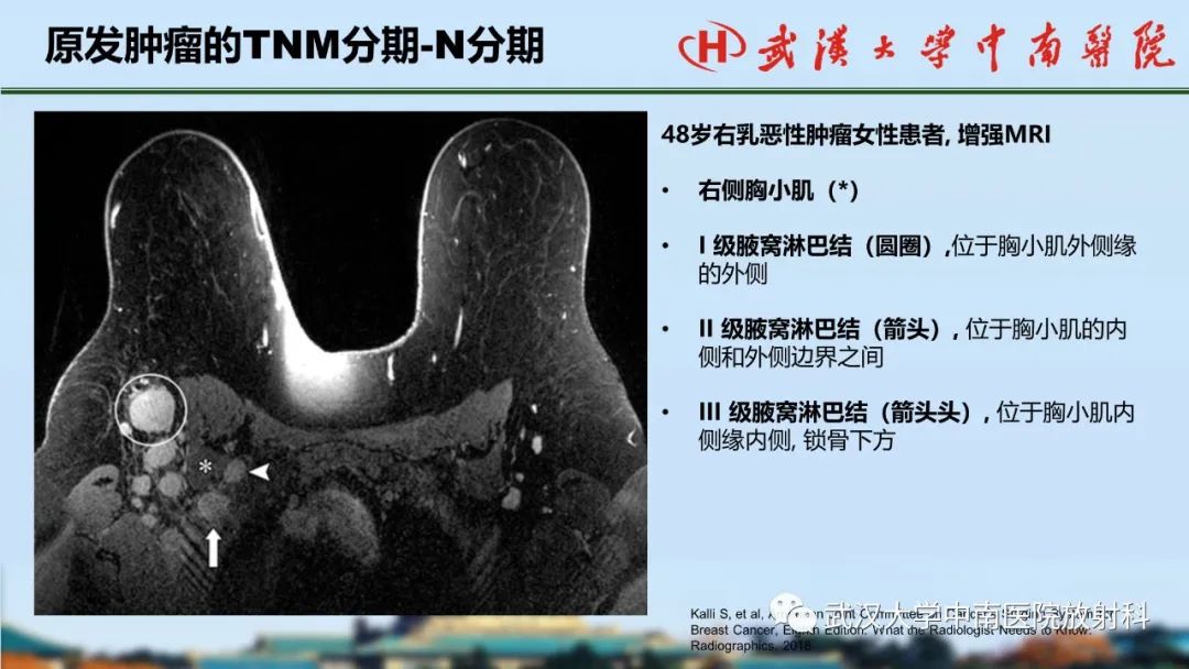 影像PPT - 【PPT】乳腺癌第八版TNM分期解读—影像科医生的责任和挑战-26