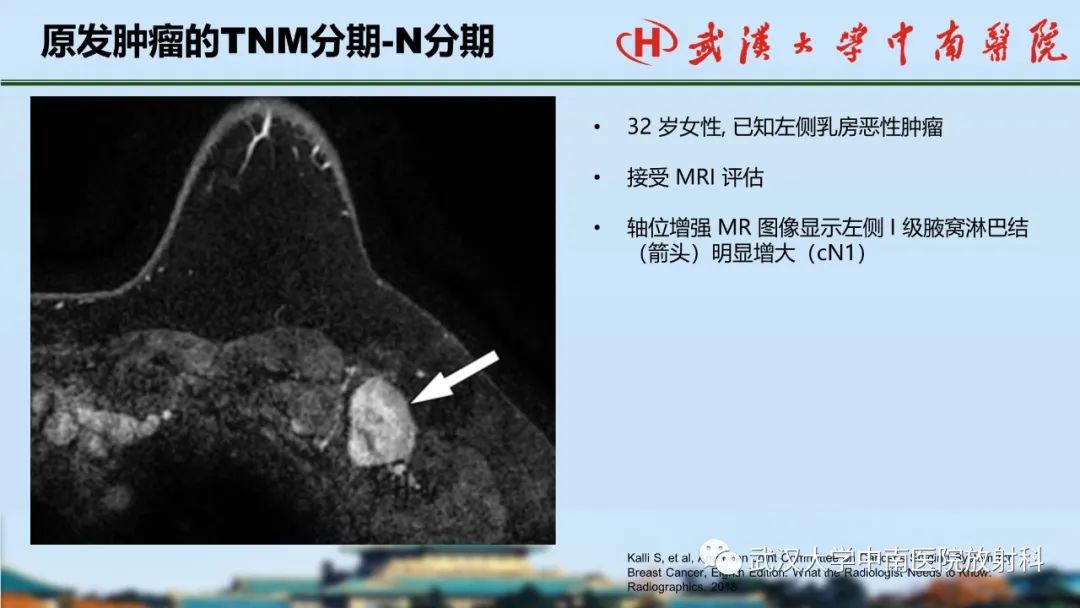 影像PPT - 【PPT】乳腺癌第八版TNM分期解读—影像科医生的责任和挑战-27