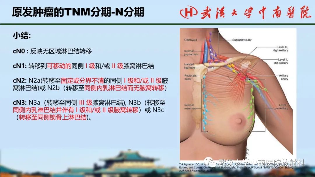 影像PPT - 【PPT】乳腺癌第八版TNM分期解读—影像科医生的责任和挑战-29