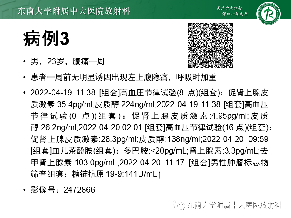 影像PPT - 【PPT】原发性腹膜后囊性病变-8