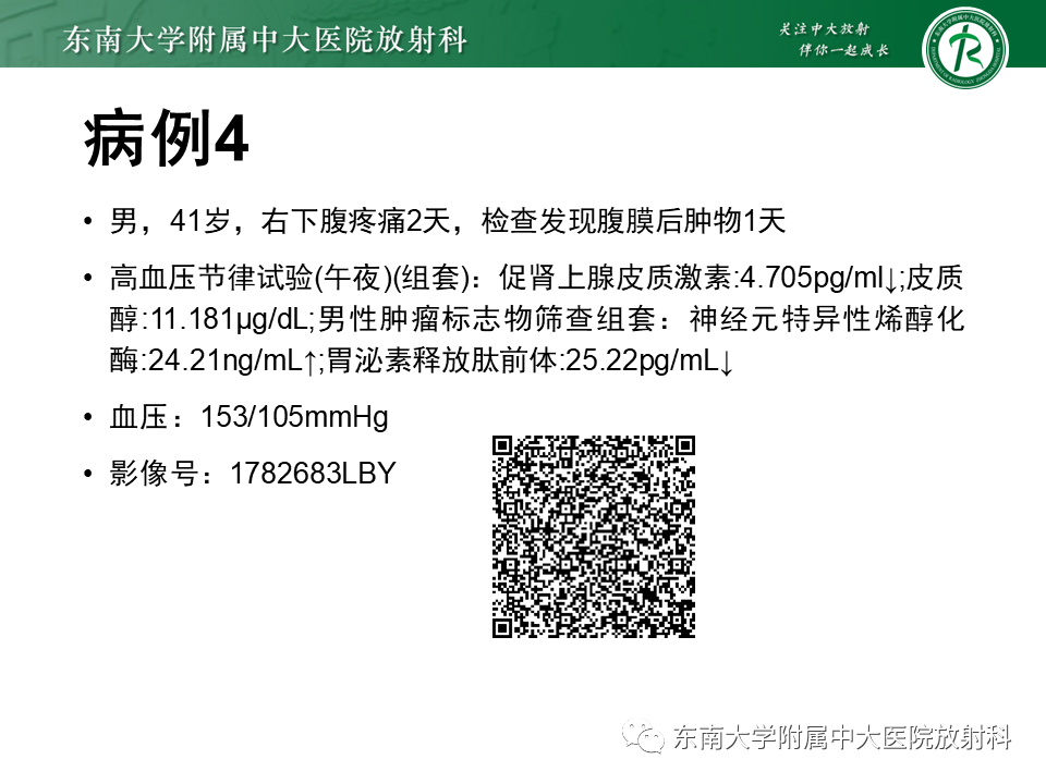 影像PPT - 【PPT】原发性腹膜后囊性病变-10