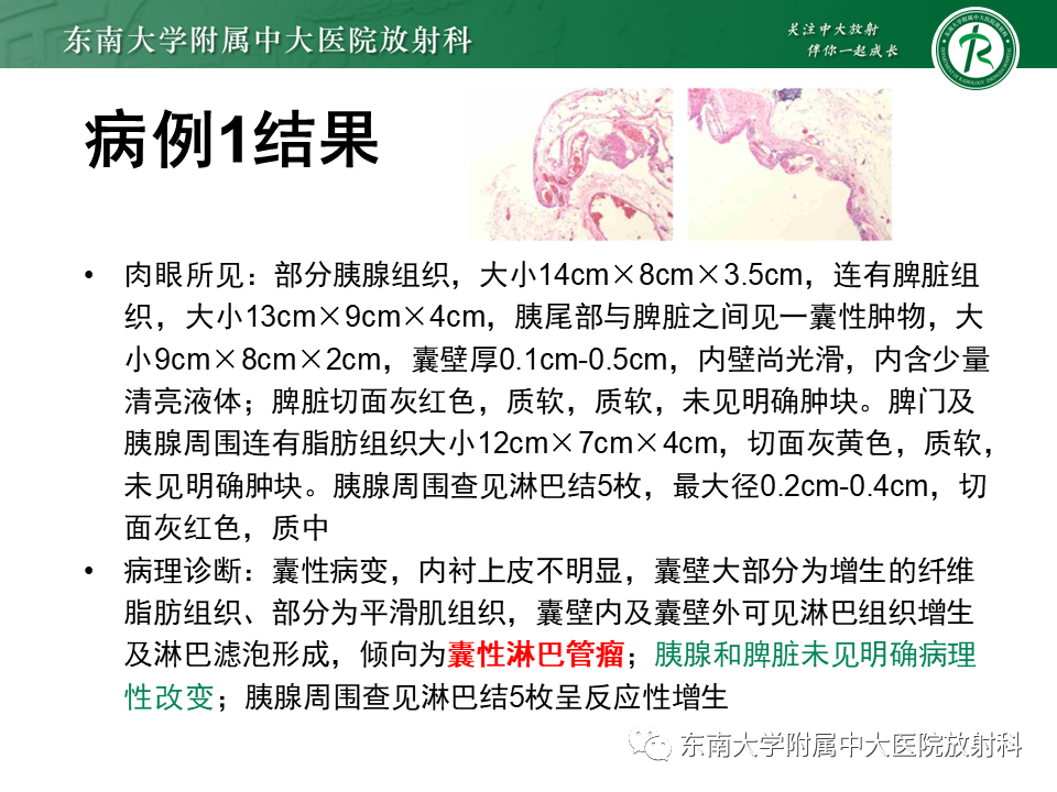 影像PPT - 【PPT】原发性腹膜后囊性病变-15