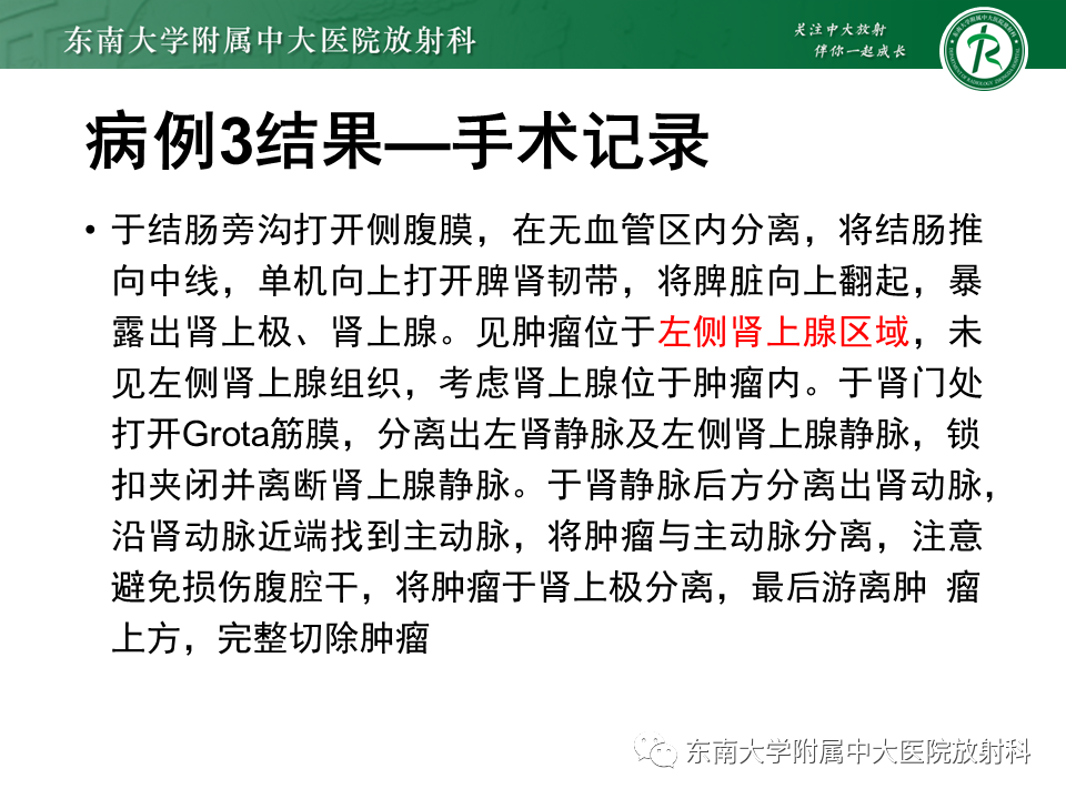影像PPT - 【PPT】原发性腹膜后囊性病变-18
