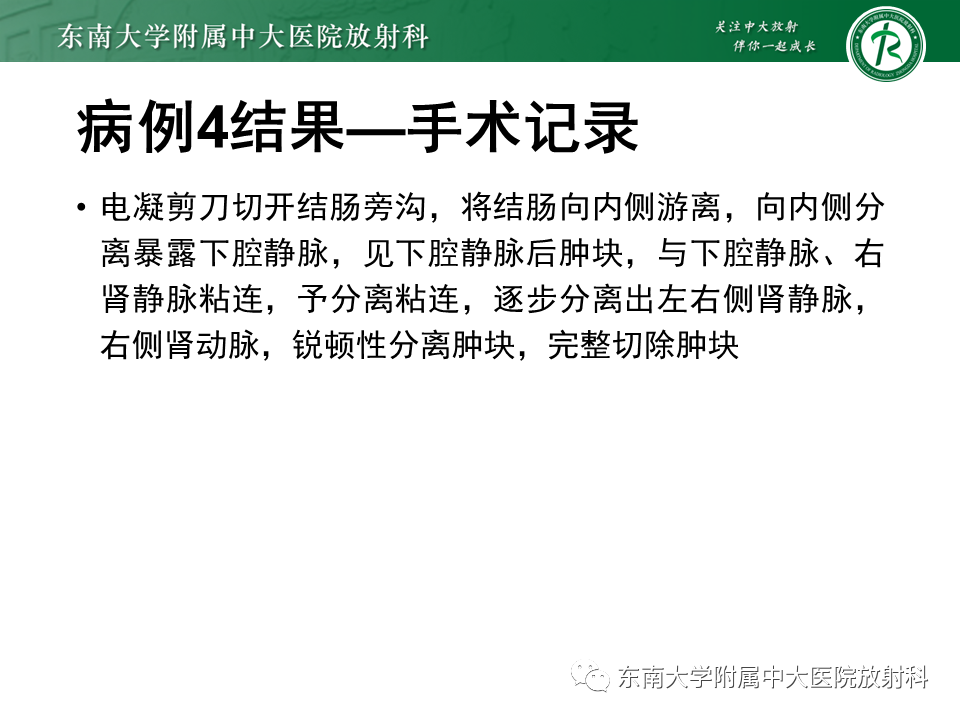 影像PPT - 【PPT】原发性腹膜后囊性病变-20