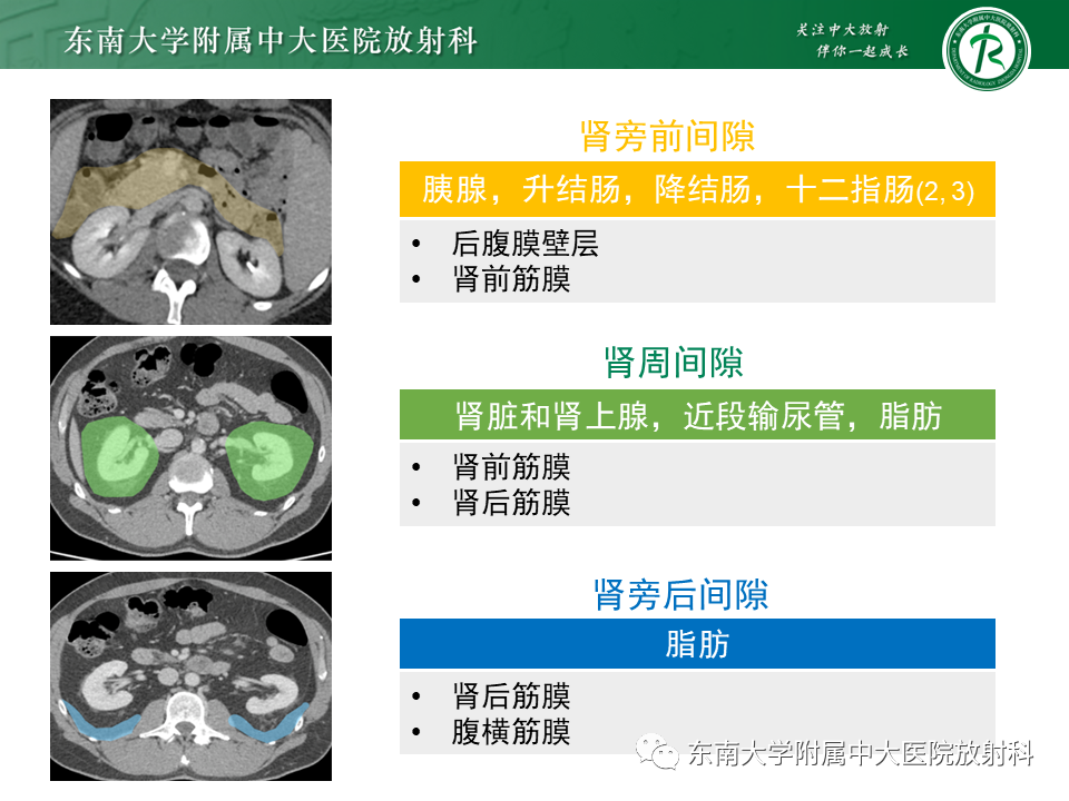 影像PPT - 【PPT】原发性腹膜后囊性病变-27