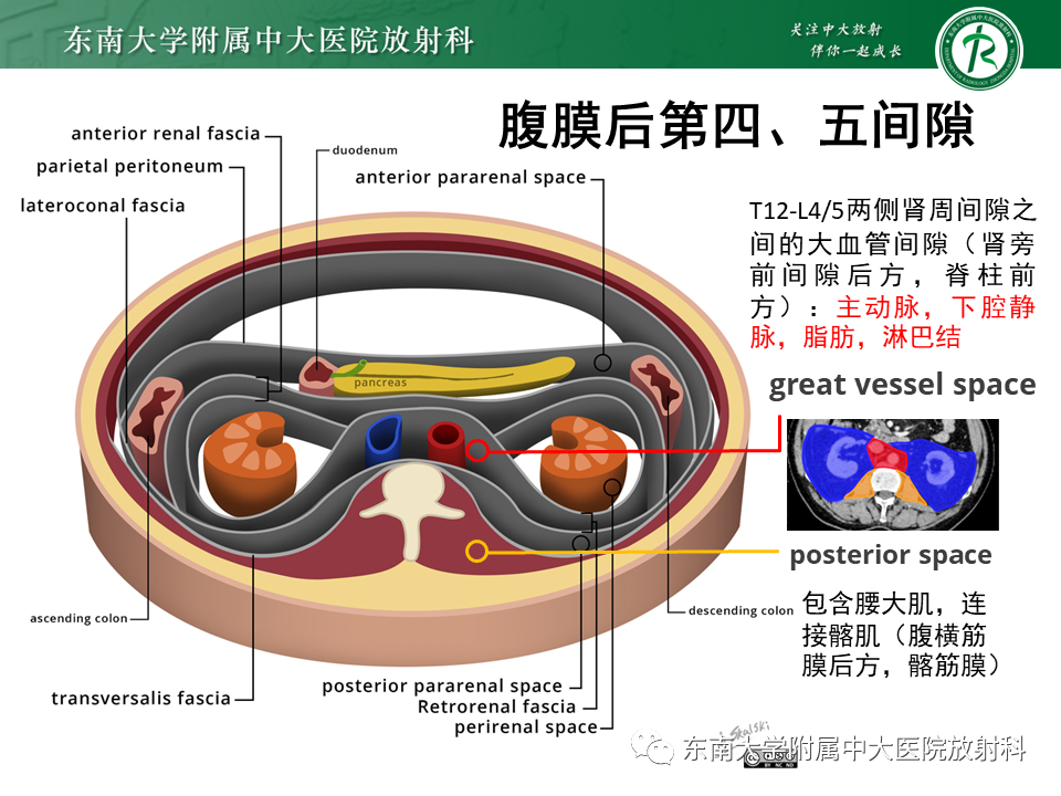 影像PPT - 【PPT】原发性腹膜后囊性病变-28