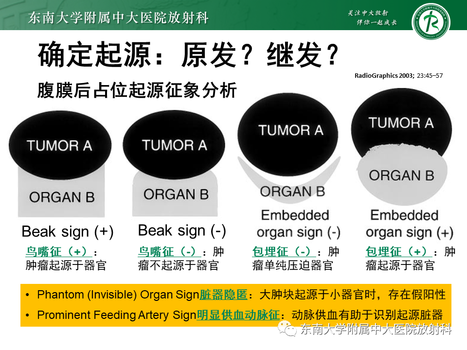 影像PPT - 【PPT】原发性腹膜后囊性病变-30