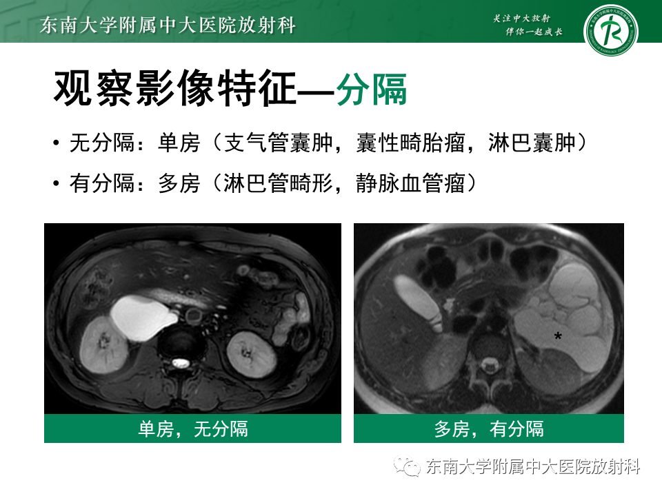 影像PPT - 【PPT】原发性腹膜后囊性病变-37