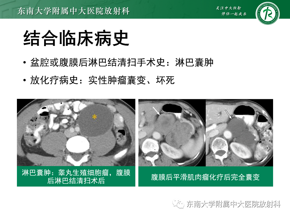 影像PPT - 【PPT】原发性腹膜后囊性病变-40