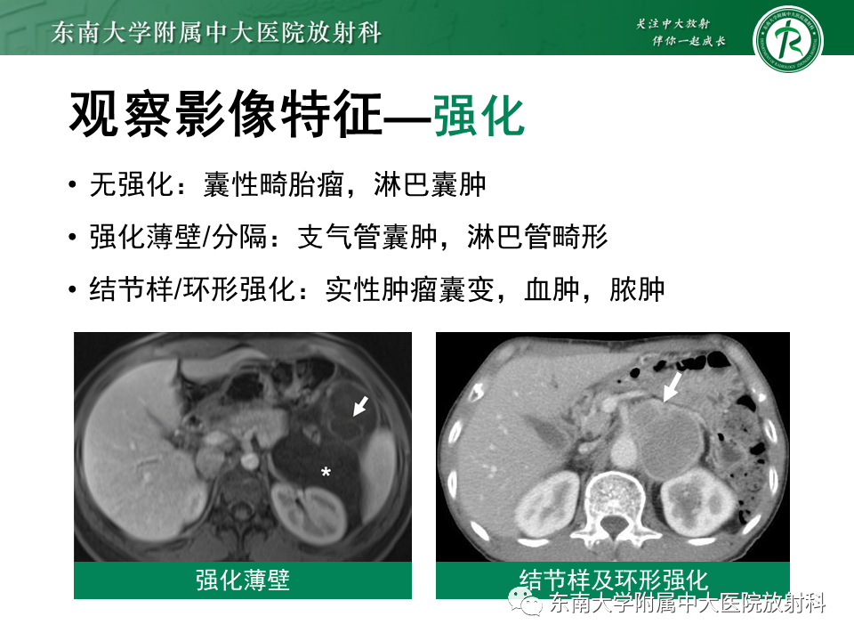 影像PPT - 【PPT】原发性腹膜后囊性病变-39