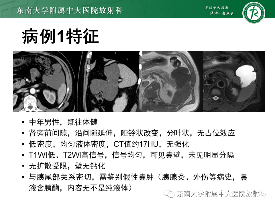 影像PPT - 【PPT】原发性腹膜后囊性病变-41
