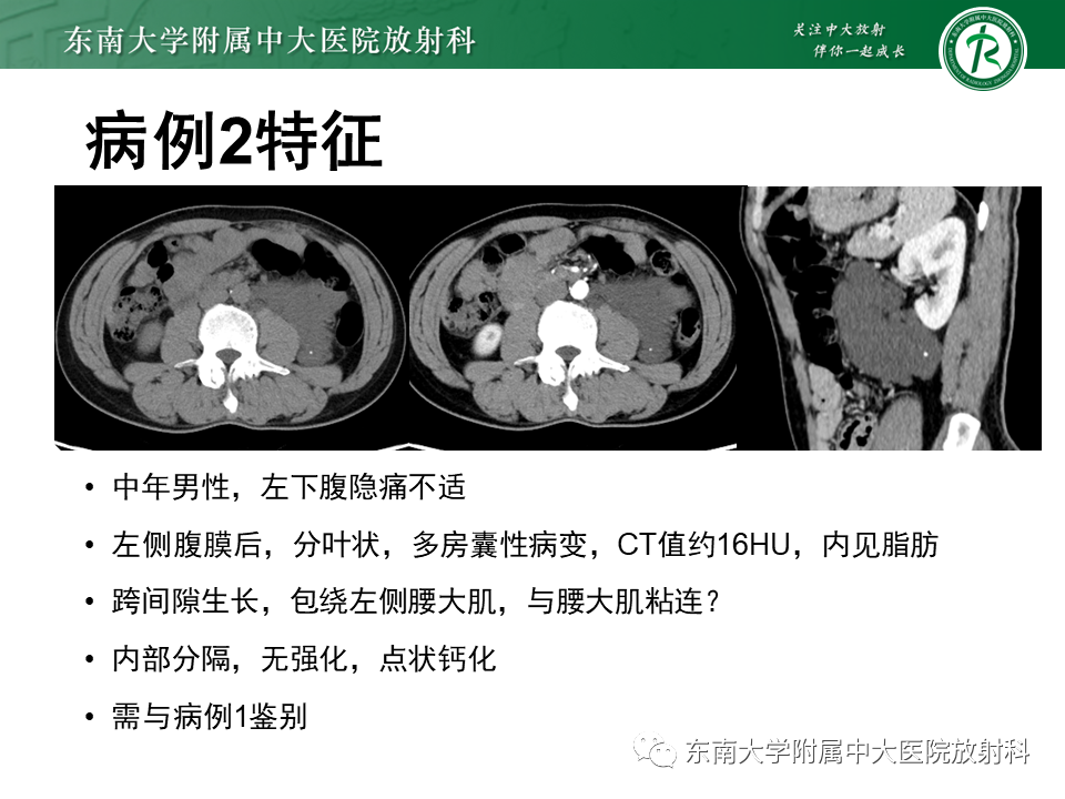 影像PPT - 【PPT】原发性腹膜后囊性病变-46