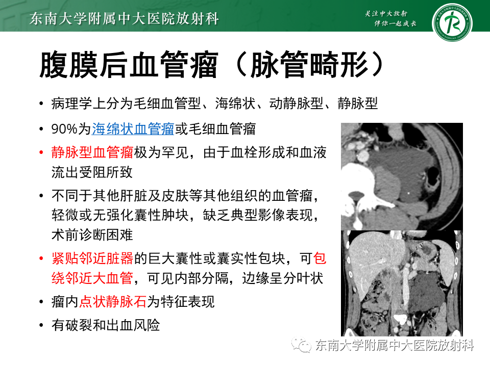 影像PPT - 【PPT】原发性腹膜后囊性病变-47