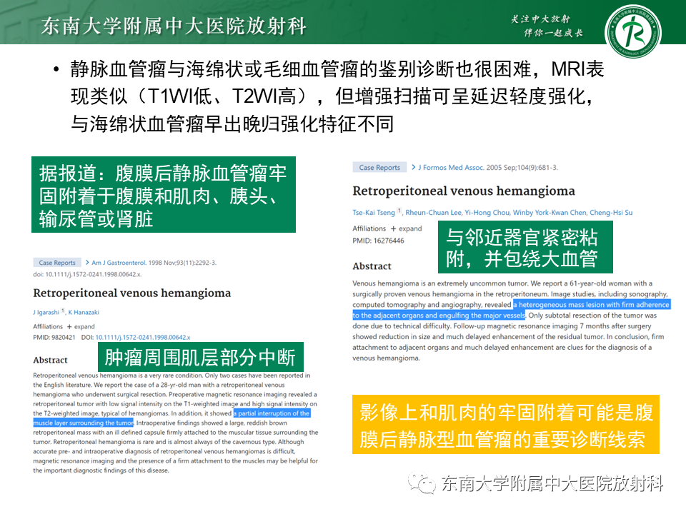 影像PPT - 【PPT】原发性腹膜后囊性病变-48