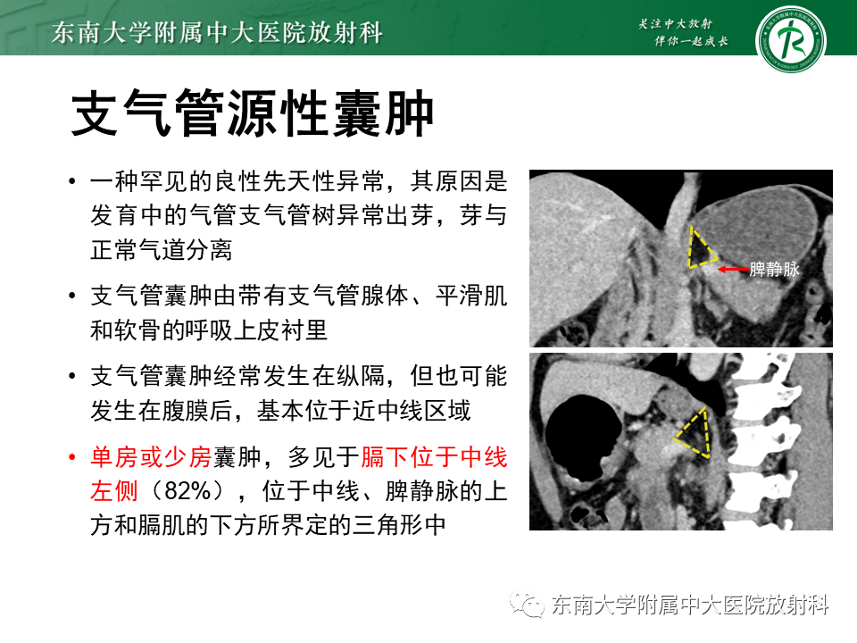 影像PPT - 【PPT】原发性腹膜后囊性病变-53