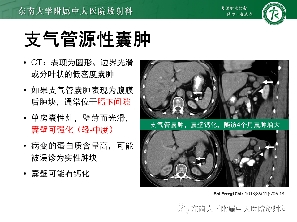 影像PPT - 【PPT】原发性腹膜后囊性病变-54