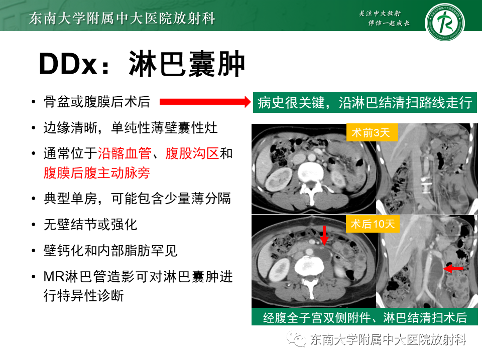 影像PPT - 【PPT】原发性腹膜后囊性病变-56