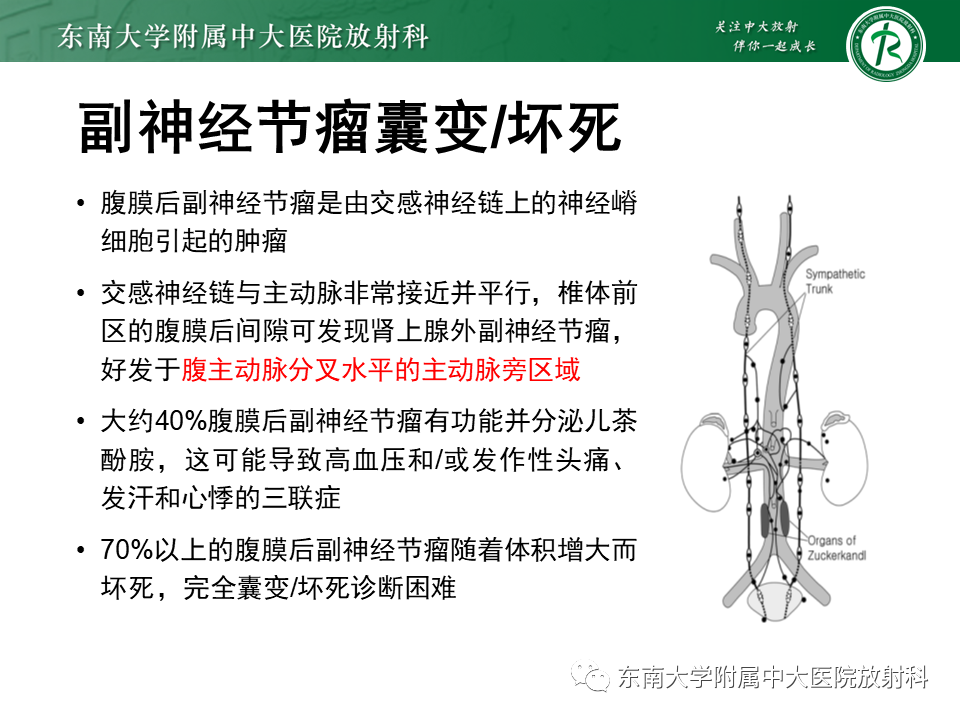 影像PPT - 【PPT】原发性腹膜后囊性病变-59