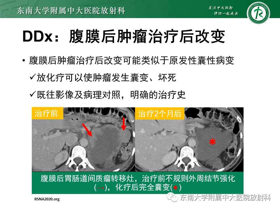 影像PPT - 【PPT】原发性腹膜后囊性病变-63