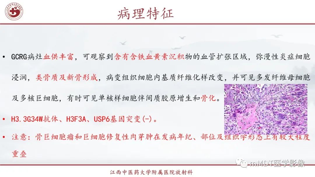 影像PPT - 【PPT】超短T2信号为主的局限性骨肌病变-5