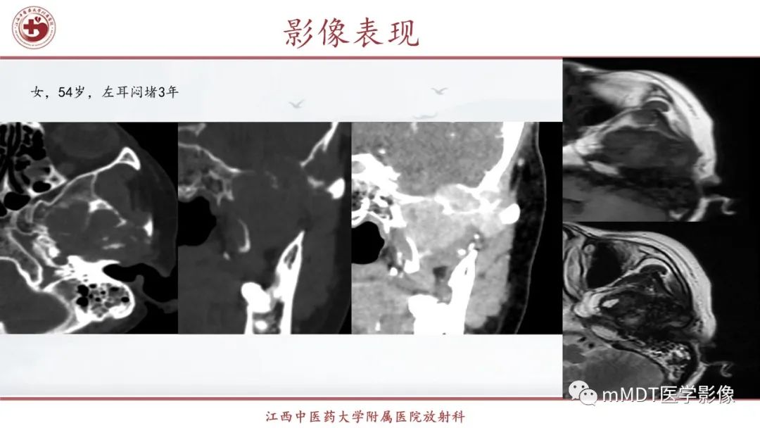 影像PPT - 【PPT】超短T2信号为主的局限性骨肌病变-7