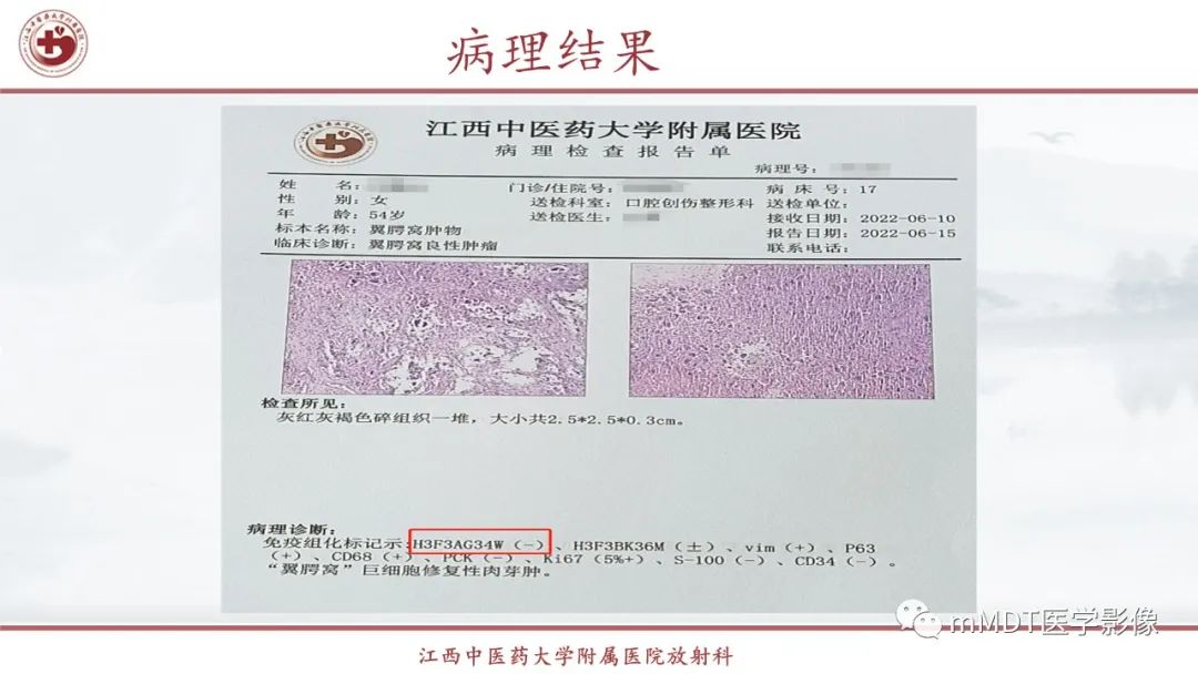 影像PPT - 【PPT】超短T2信号为主的局限性骨肌病变-8