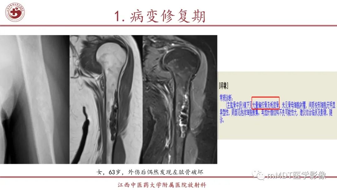 影像PPT - 【PPT】超短T2信号为主的局限性骨肌病变-26