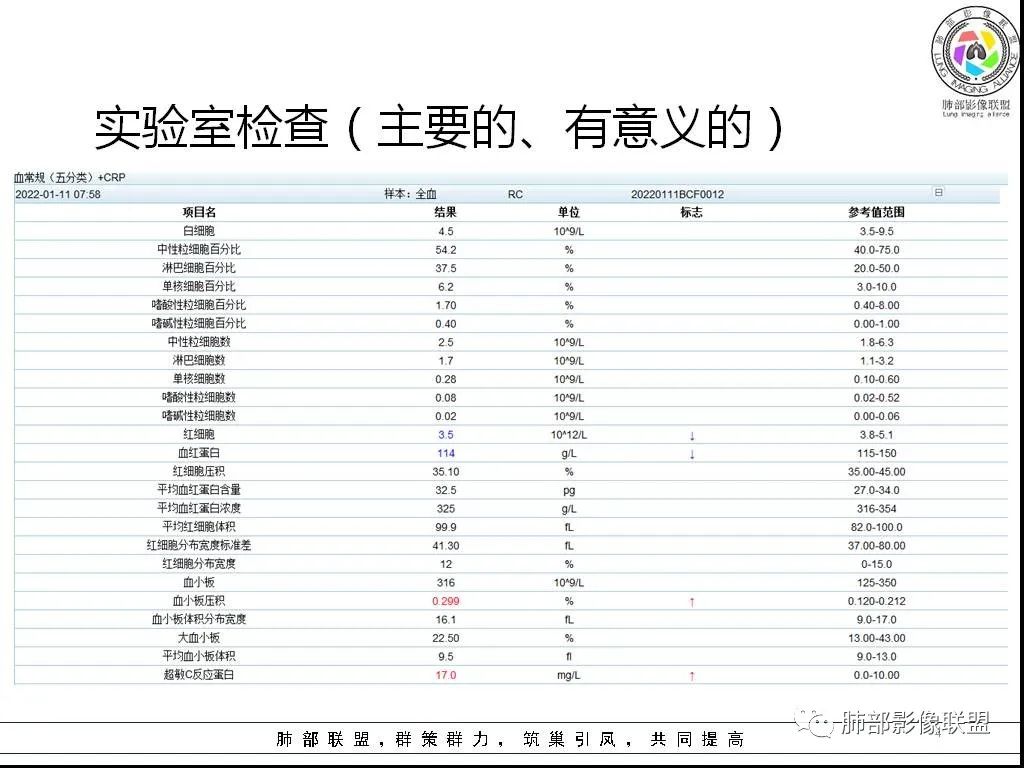 影像PPT - 【病例】鹦鹉热与军团之纠结-4 影像PPT - 【病例】鹦鹉热与军团之纠结-4