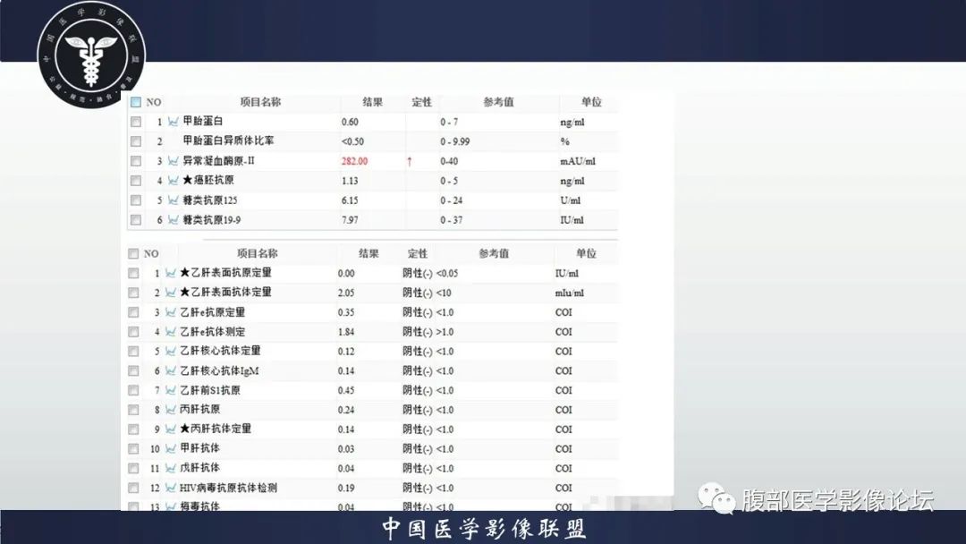影像PPT - 【病例】肝脏肝细胞腺瘤1例MR影像-3
