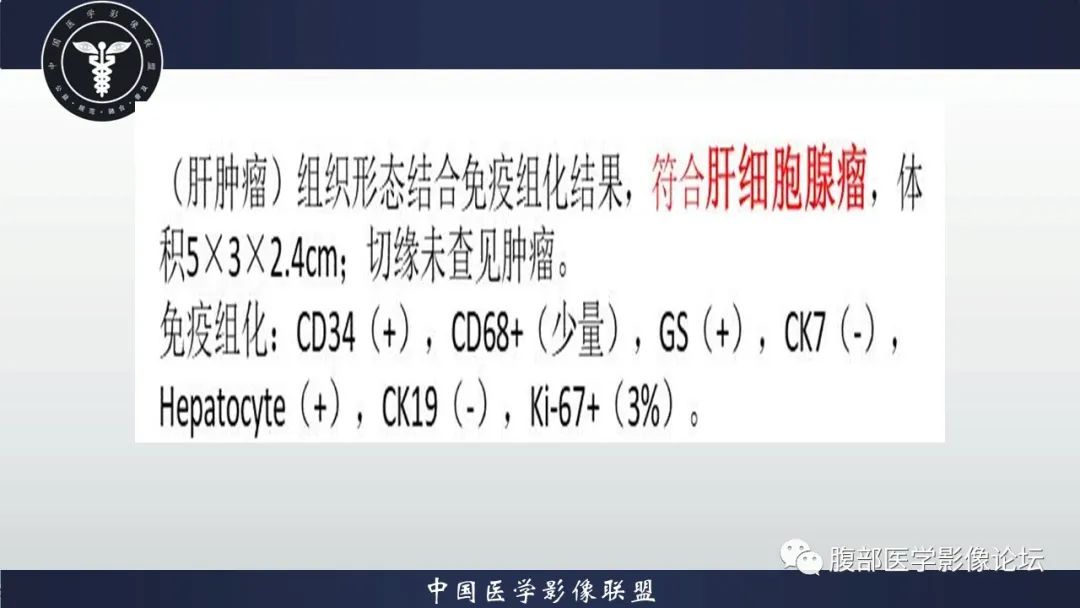 影像PPT - 【病例】肝脏肝细胞腺瘤1例MR影像-13