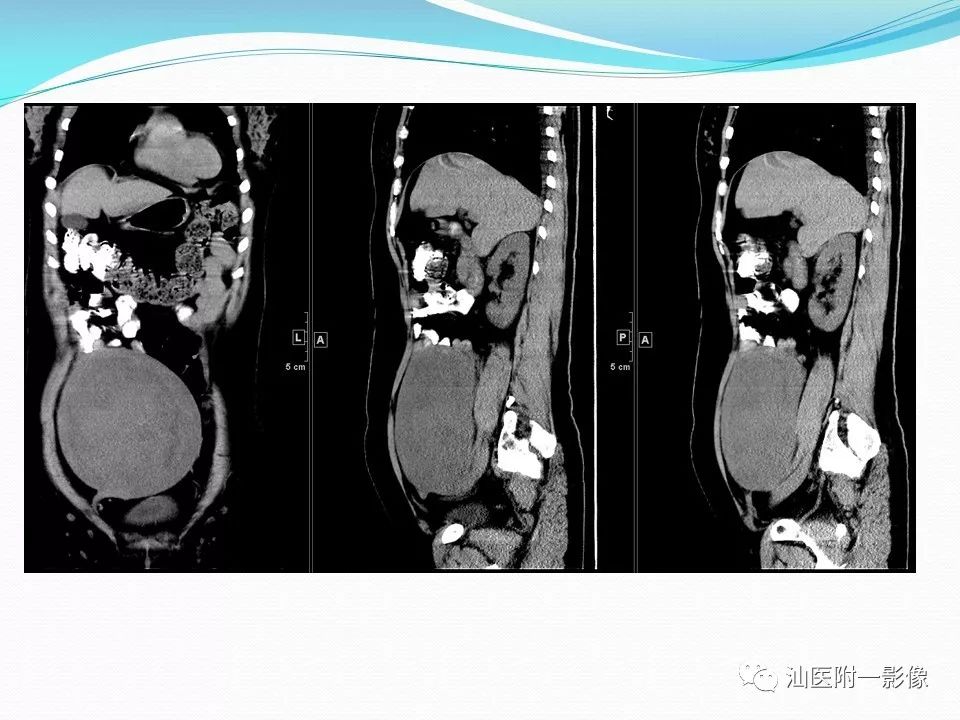 影像PPT - 【PPT】女性盆腔结构解剖复习-12